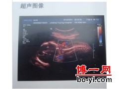 医用彩超B超胶片打印机 OKIC711dn型号图1